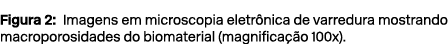 Figura 2: Imagens em microscopia eletr nica de varredura mostrando macroporosidades do biomaterial (magnifica o 100x).