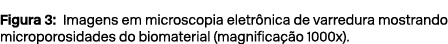 Figura 3: Imagens em microscopia eletr nica de varredura mostrando microporosidades do biomaterial (magnifica o 1000x).