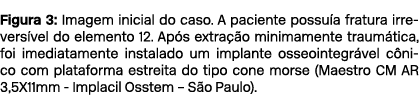 Figura 3: Imagem inicial do caso. A paciente possu a fratura irrevers vel do elemento 12. Ap s extra o minimamente t...