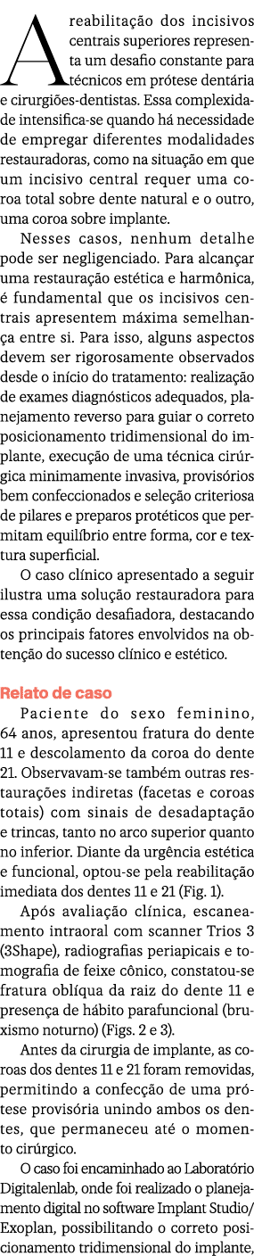 A reabilita o dos incisivos centrais superiores representa um desafio constante para t cnicos em pr tese dent ria e ...