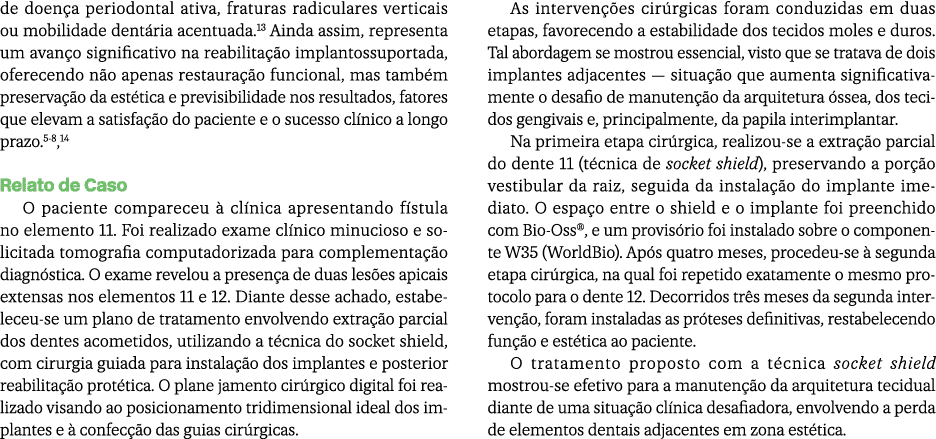de doen a periodontal ativa, fraturas radiculares verticais ou mobilidade dent ria acentuada.13 Ainda assim, represen...
